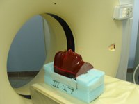 CT scans and public health